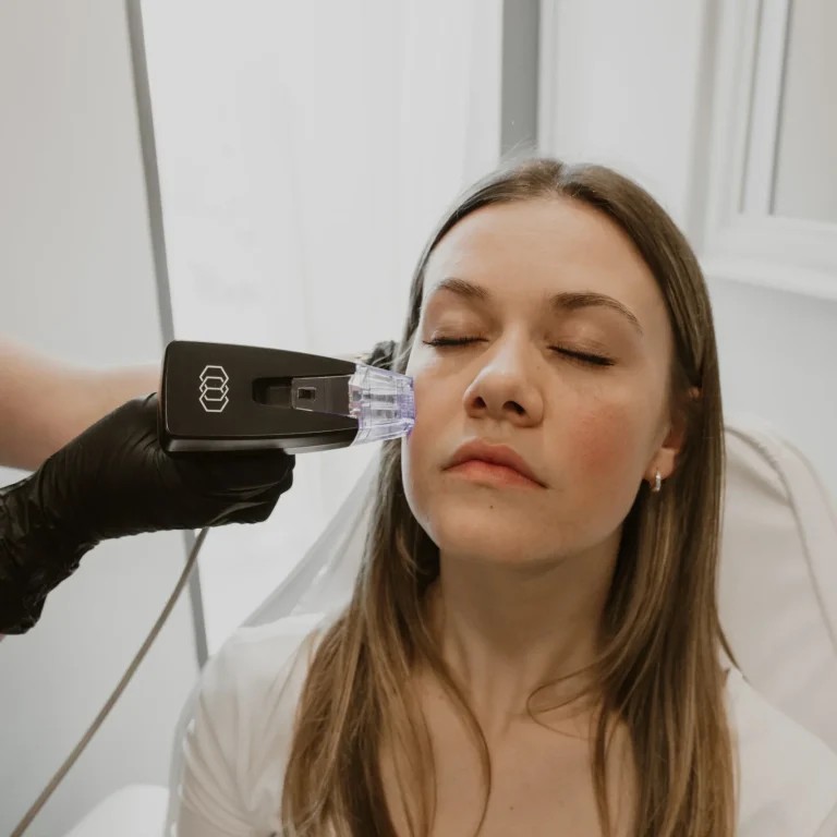 a woman receiving a morpheus8 treatment