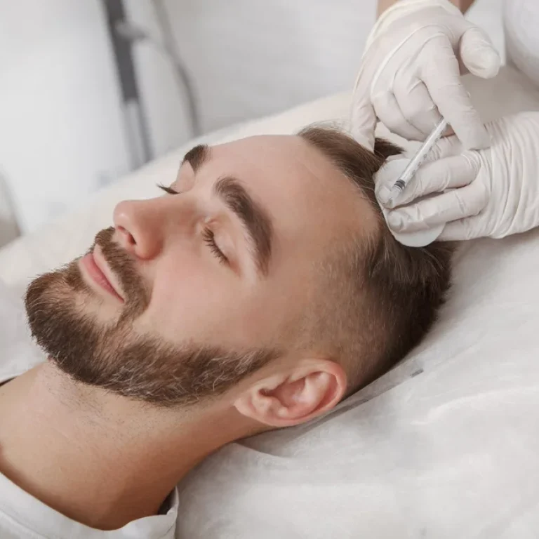 A man receiving a prp treatment for hair regeneration